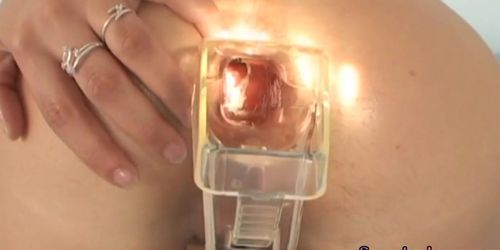 Speculum babe toys pussy with vibrator before anal gaping