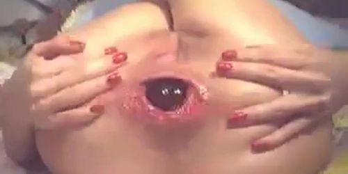 Webcam girl glass ball in ass  prolapse 2