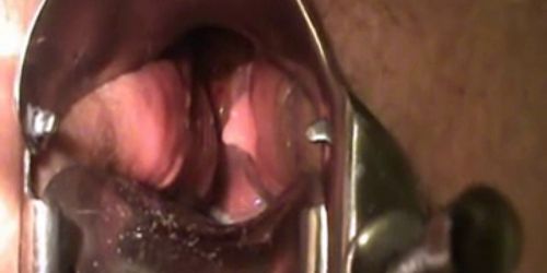 bbw masturbate with speculum show cervix contracting or