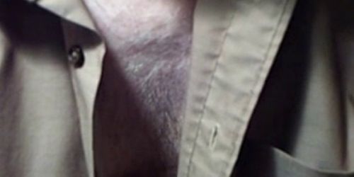 Doctor examines patient's man boobs