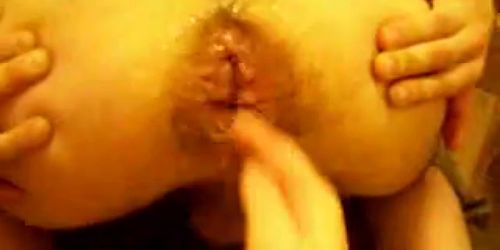 Asshole extrem - anal fisting Gape