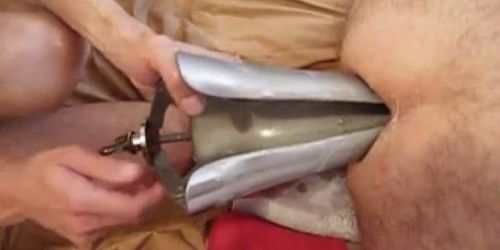 Monster Speculum Anal