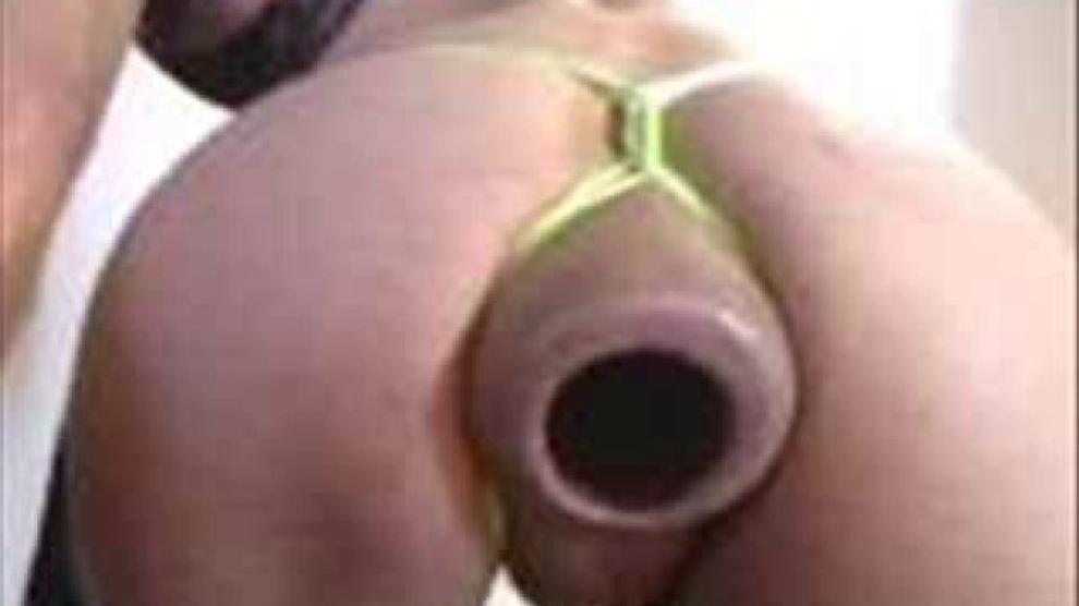 Anal extrem Fisting Tubes